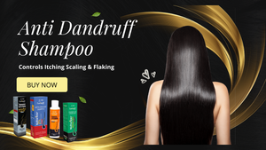 Ditch the Itch with the Right Anti-Dandruff Shampoo