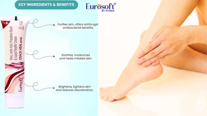 EUROSOFT CRACK HEAL: The Ultimate Solution for Heels