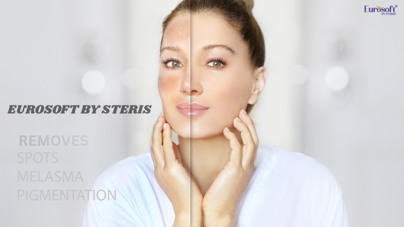 How To Remove Pigmentation From Face Permanently In Hindi