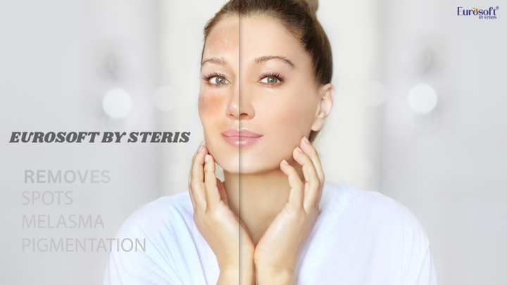 How To Remove Pigmentation From Face Permanently In Hindi