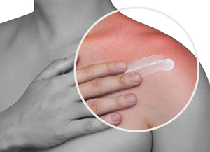 Say Goodbye to Itchy Skin with Eurosoft Anti-Itch Cream